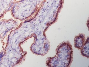 Duolink� In Situ Detection Reagents Brightfield 