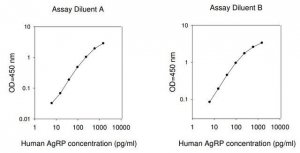 Human AGRP / Agouti-related Protein ELISA Kit RAB0529-1KT