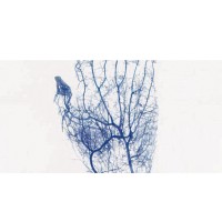 Искатель вен BK-VIA100 Biobase