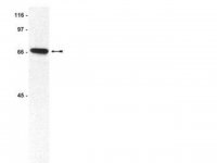 ATM/Chk2 Pathway Explorer Antibody MiniPack 15-116