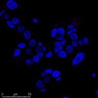 BioTracker TiY Vimentin Live Cell Dye SCT059