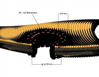 Streptolysin O from Streptococcus pyogenes 