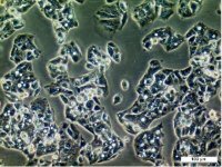 Hep G2 Cell Line human 