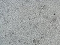 K562 Cell line human 