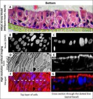 Human Bronchial Epithelial Cells: HBEpC, adult 502-05A