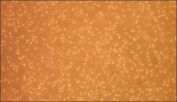 Human Peripheral Blood Monocytes: HPBM 6906-50A