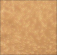 Human Peripheral Blood T Cells: HPBT 6902-50A