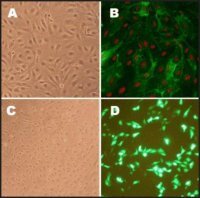 Human Pulmonary Artery Endothelial Cells: HPAEC, adult 302-05A