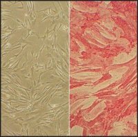Human Pulmonary Artery Smooth Muscle Cells: HPASMC, adult 352-05A