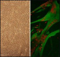 Human Skeletal Muscle Cells: HSkMC, adult 150-05A