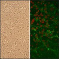 Human Subclavian Artery Endothelial Cells: HScAEC, adult 3010-05A
