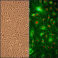 Human Umbilical Artery Endothelial Cells: HUAEC, neonatal 202-05N
