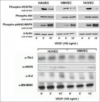 Human Umbilical Vein Endothelial Cells: HUVEC: Pre-Screened for Angiogenesis &amp; VEGF signaling, neonatal S200-05N