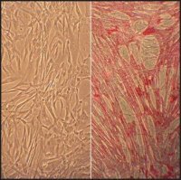 Human Umbilical Vein Smooth Muscle Cells: HUVSMC, neonatal 250-05N