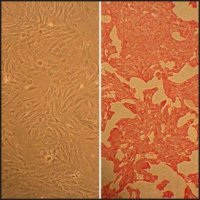 Rat Aortic Smooth Muscle Cells: RAOSMC, adult R354-05A
