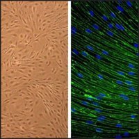 Rat Brain Microvascular Endothelial Cells: RBMVEC, adult R840-05A
