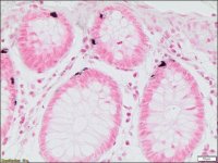Argentaffin TISSUE-TROL� Control Slides TTR013-25EA