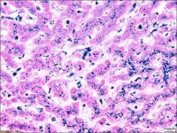 Iron TISSUE-TROL� Control Slides 