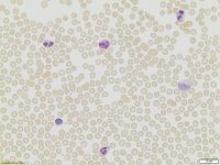 Leukocyte Alkaline Phosphatase Kit 86R-1KT