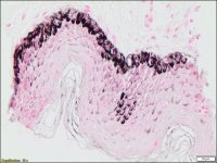 Melanin TISSUE-TROL� Control Slides TTR014-25EA
