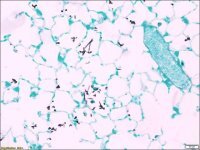 Silver methenamine 