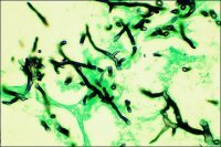 Silver Stain (Modified GMS) Kit HT100A-1KT