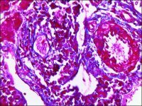 Trichrome Stain (Masson) Kit HT15-1KT