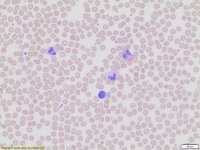 Wright-Giemsa Stain, Modified WG128-4L