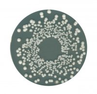 Orange Serum agar 