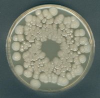Orange Serum agar 