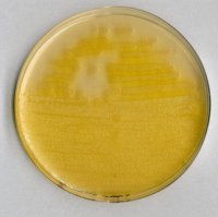 Pseudomonas agar F (base) 