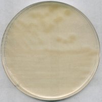 R2A Agar 