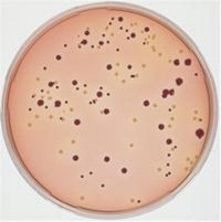 SMAC agar base 