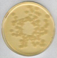 Tryptic Soy Agar 