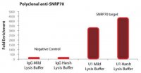 Imprint® RNA Immunoprecipitation Kit RIP-12RXN