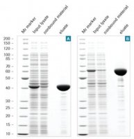 cOmplete� His-Tag Purification Column 