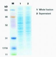 cOmplete™ Lysis-M 4719956001