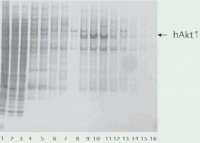 cOmplete™, EDTA-free Protease Inhibitor Cocktail