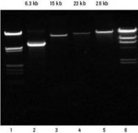 High Pure PCR Template Preparation Kit 11796828001