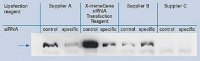 X-tremeGENE™ siRNA Transfection Reagent
