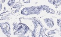Anti- Tubulin Antibody, clone 10G11 ZooMAb® Rabbit Monoclonal