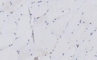 Anti--Dystroglycan Antibody, clone VIA4-1 ZooMAb® Mouse Monoclonal