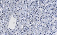 Anti--Glucocerebrosidase Antibody, clone 2I15 ZooMAb® Rabbit Monoclonal