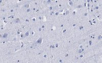 Anti--synuclein Antibody, clone 1D22 ZooMAb® Rabbit Monoclonal