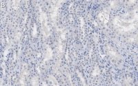 Anti--Tubulin Antibody, clone DM1A ZooMAb® Mouse Monoclonal