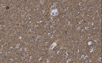 Anti--Tubulin III Antibody, clone 5H16, ZooMAb® Rabbit Monoclonal