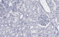 Anti-53BP1 Antibody, clone 1H16 ZooMAb® Rabbit Monoclonal