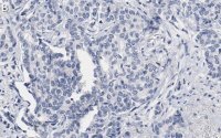 Anti-53BP1 Antibody, clone BP13 ZooMAb® Mouse Monoclonal