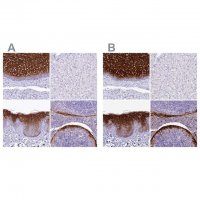 Anti-A2ML1 antibody produced in rabbit