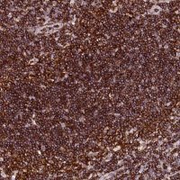 Anti-AAAS antibody produced in rabbit